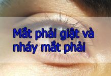 Mắt phải giật