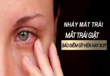 Mắt trái giật